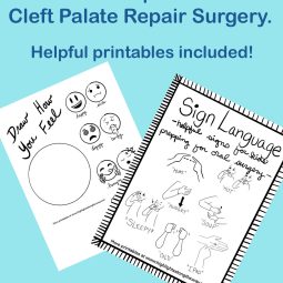 Cleft Palate Repair Surgery printables